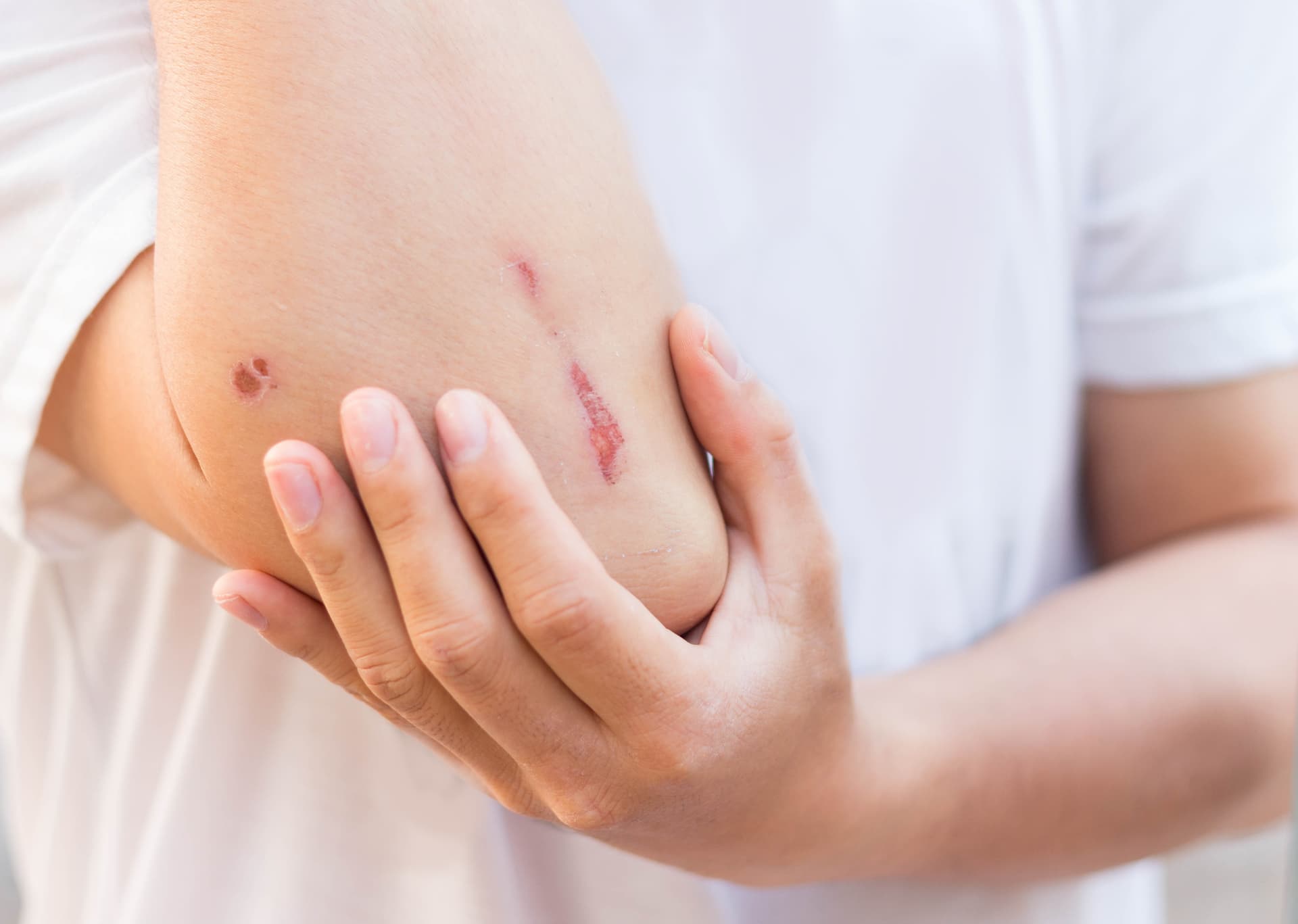 Proven Methods for Fast Wound Healing